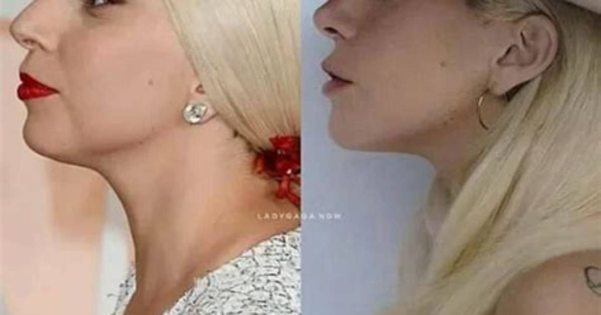 Lady Gaga S Journey as A